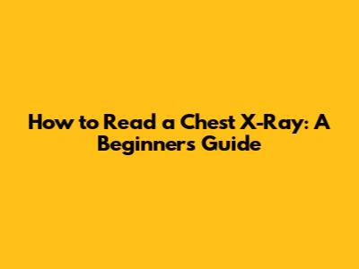 How to Read a Chest X-Ray: A Beginner's Guide